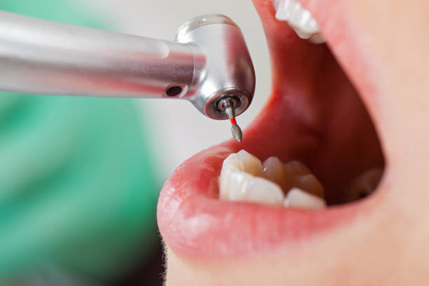 Best Cosmetic Emergency Dentistry in Gordonsville, TN